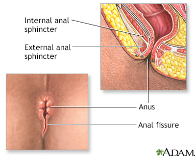 tearing the anal sphincter Mature amataur big boobs