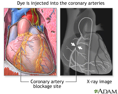 Inderal depression x ray