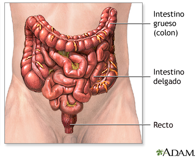 Resección Del Intestino Grueso
